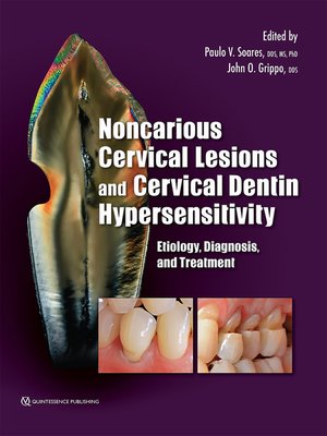cover image of Noncarious Cervical Lesions and Cervical Dentin Hypersensitivity